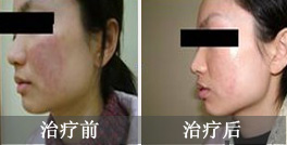 皮炎的病因有哪些